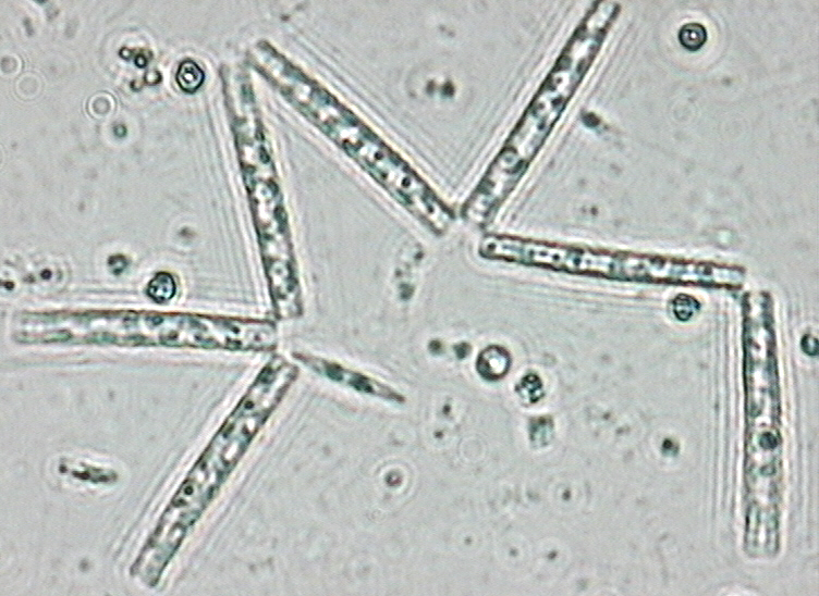 Dictyocha speculum